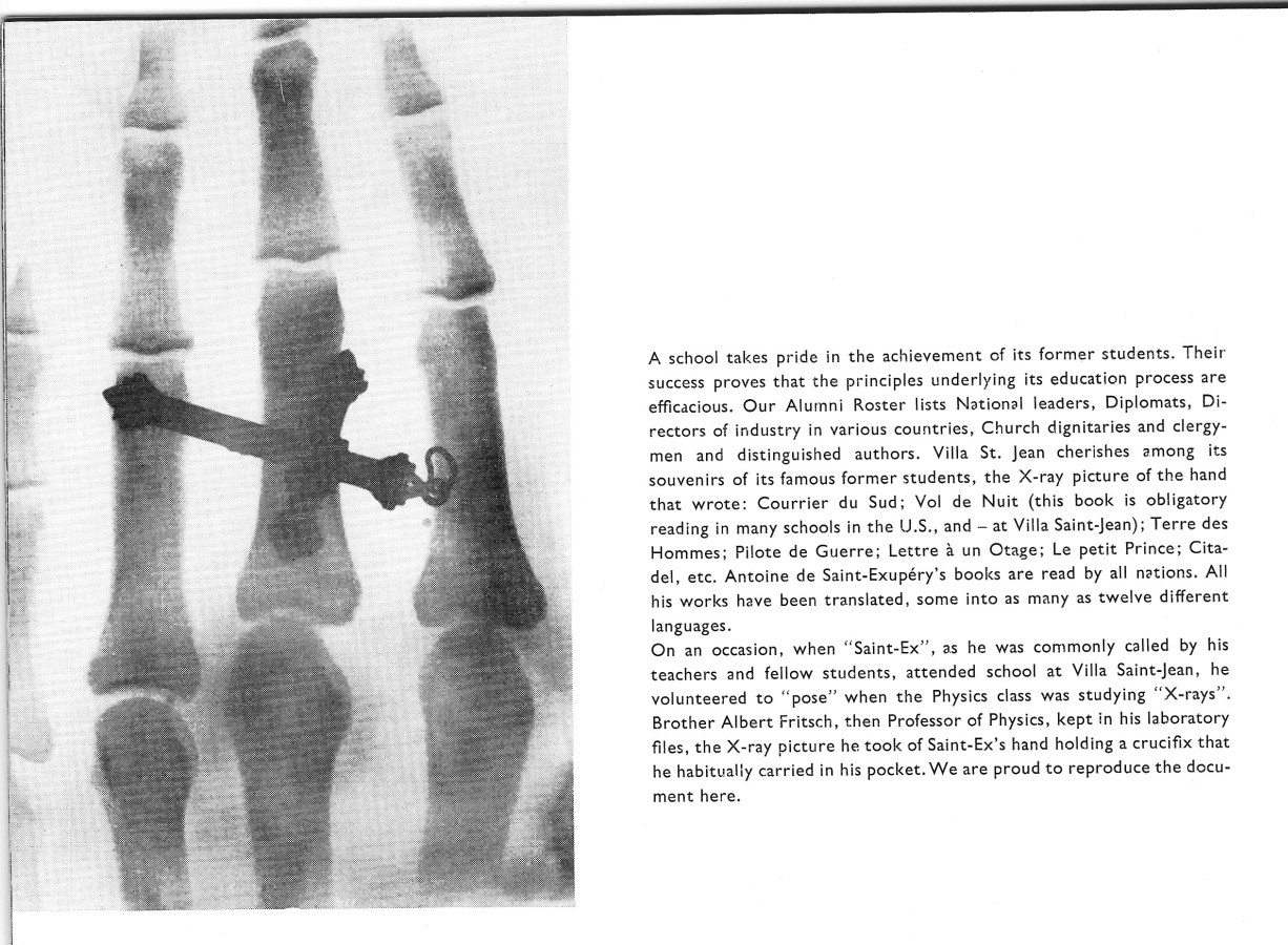 PHOTOS of Villa Saint Jean International School X Ray of Antoine de Saint-Exupery's Hand 